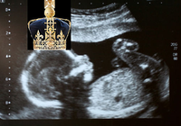 Baby Kate Baby Kate